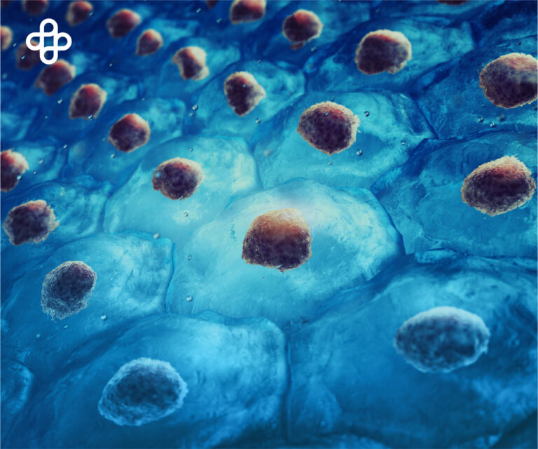 Células madre multipotentes Centro Médico Eternal