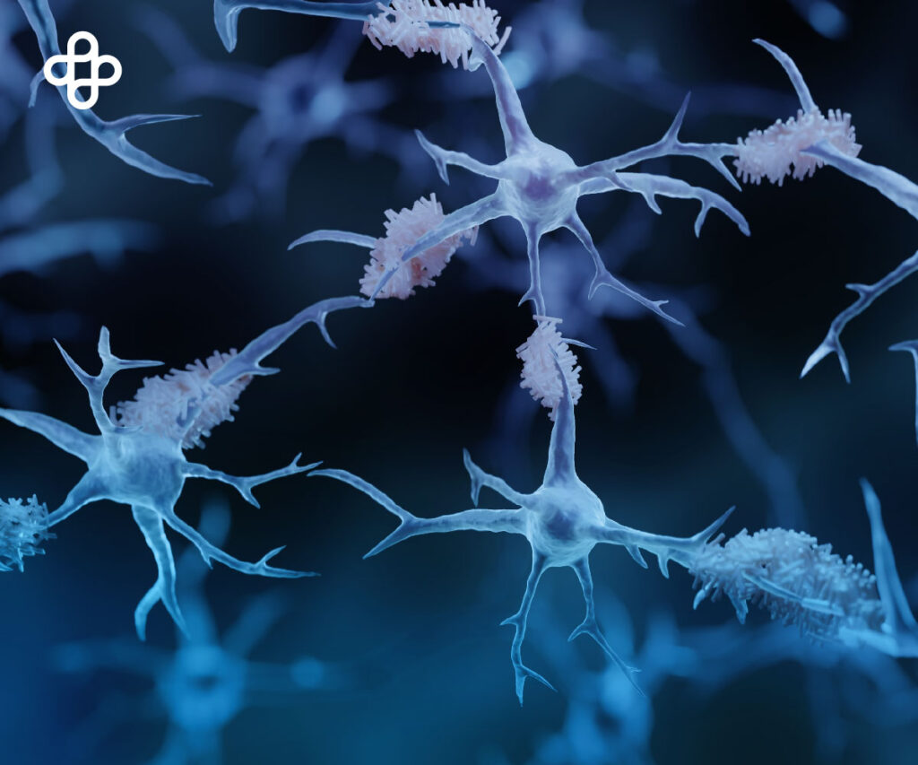 la medicina regenerativa en la comprensión del Alzheimer